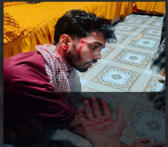 নোয়াখালী বেগমগঞ্জে গায়ে হলুদে যাওয়ার পথে দুর্বৃত্তের গুলিবর্ষণে আহত ৫