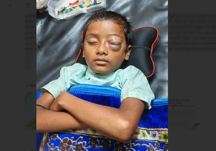 নোয়াখালীতে চোখে আঘাতের চিকিৎসা নিতে গিয়ে শিশু মৃত্যুর অভিযোগে হাসপাতাল বন্ধ
