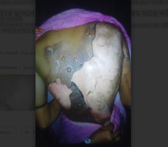 সুবর্ণচরে ছাগলে শিমগাছ খাওয়া নিয়ে বিরোধে গরম মাড়ে নারীকে ঝলসে দিয়েছে